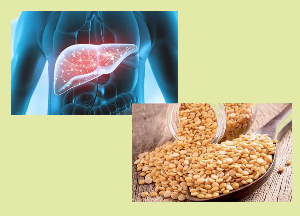 خواص لپه برای کبد چرب-درمان طبیعی و مؤثر با یک حبوبات ساده